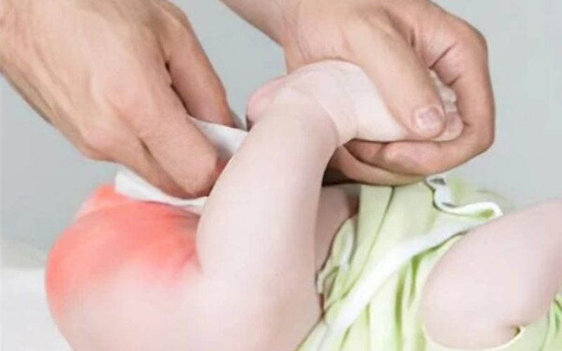 dấu hiệu khăn ướt kém chất lượng cho bé